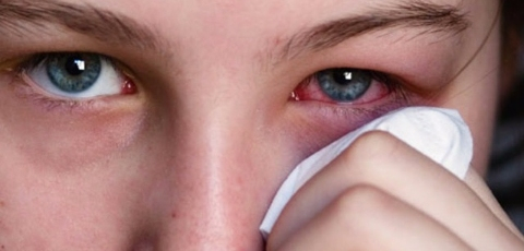 Alergias oculares aumentam com a chegada da primavera